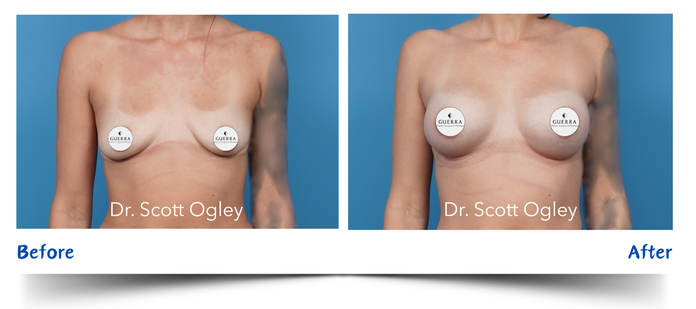 Real patient before and after photo 18994 by Dr. Ogley