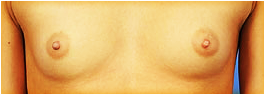 small breasts
