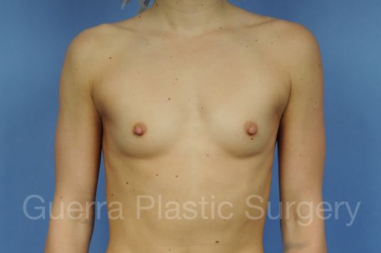 prev Case #1002164 Before