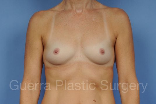 next Case #19887 Before