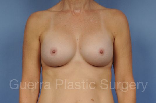 next Case #19887 After