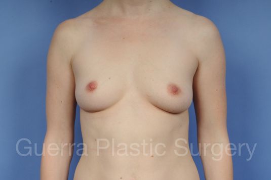 prev Case #1002174 Before