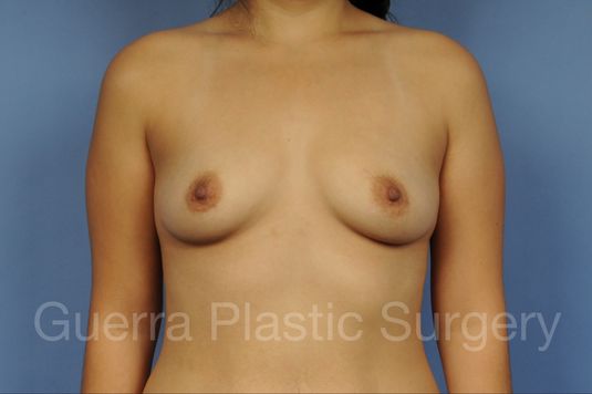 prev Case #1002179 Before