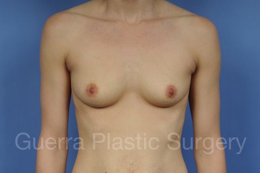 prev Case #1001175 Before