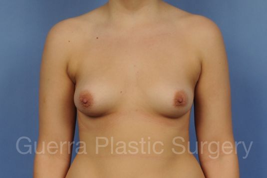 prev Case #1001176 Before