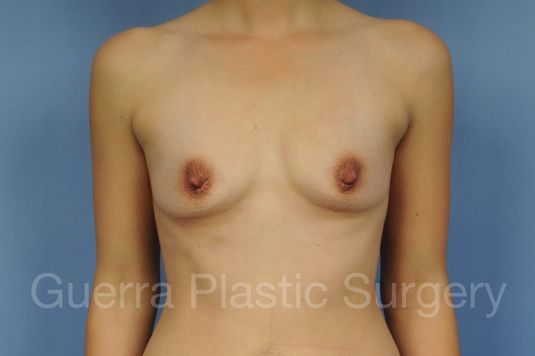 prev Case #1001178 Before