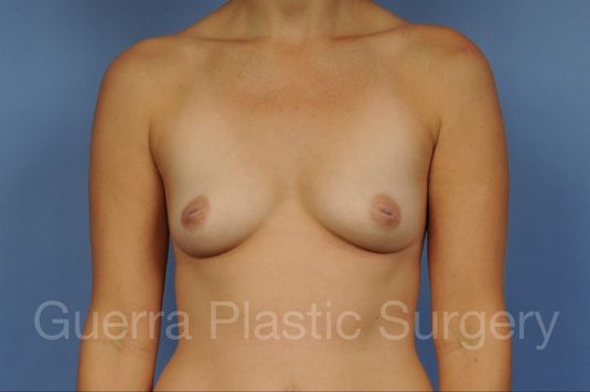 prev Case #1005001 Before