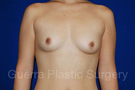 prev Case #31847 Before