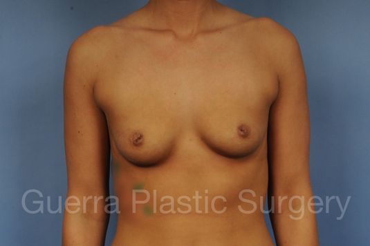 prev Case #1002041 Before