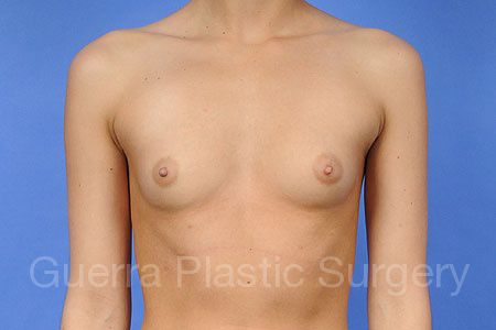 prev Case #34110 Before