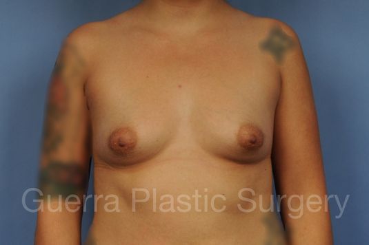 prev Case #1002184 Before