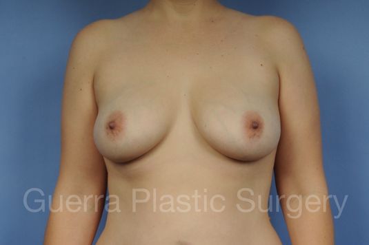 prev Case #1002186 Before