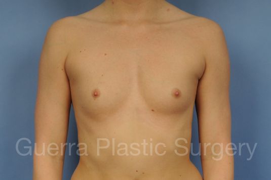 prev Case #21282 Before