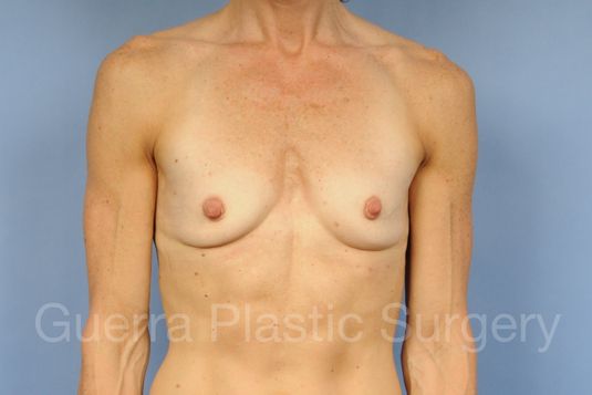 prev Case #1001193 Before