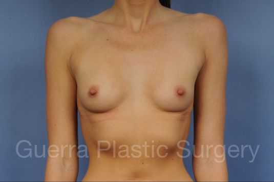 prev Case #1001194 Before