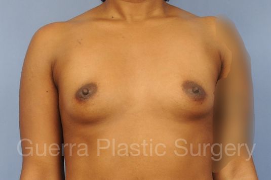 prev Case #1001200 Before