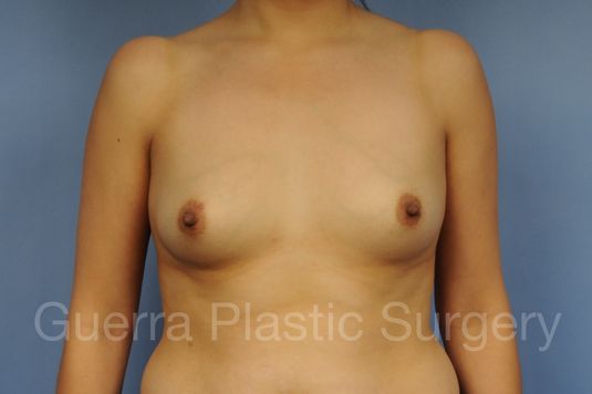 prev Case #1001201 Before