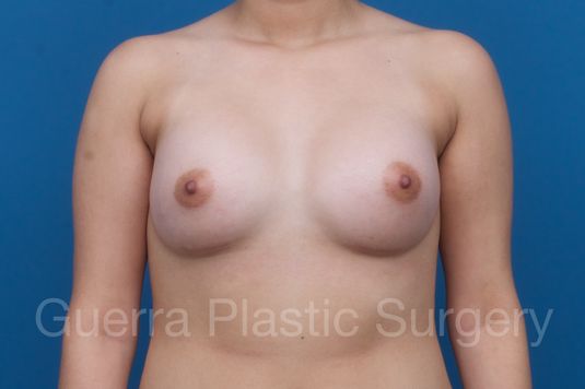 next Case #1001203 After