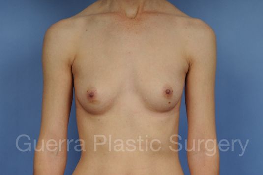 prev Case #1001206 Before