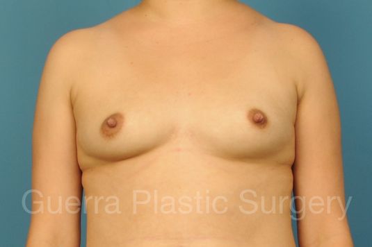 prev Case #1001207 Before