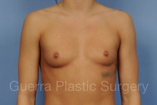 prev Case #1001209 Before