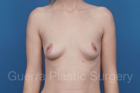 prev Case #29091 Before