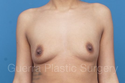 prev Case #1006007 Before