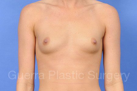 prev Case #30217 Before