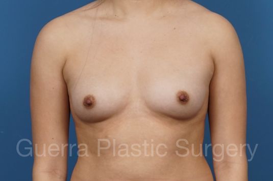 prev Case #34699 Before