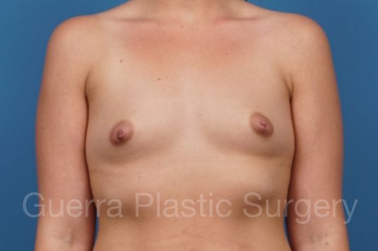 prev Case #35035 Before