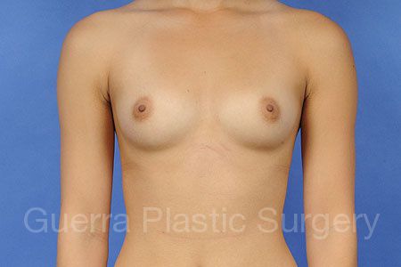 next Case #30993 Before