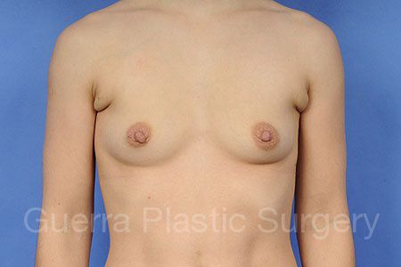 prev Case #30932 Before