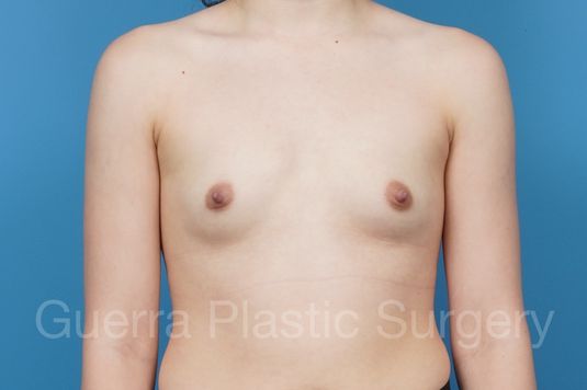 next Case #39848 Before