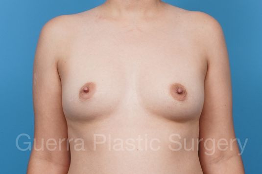 prev Case #39785 Before