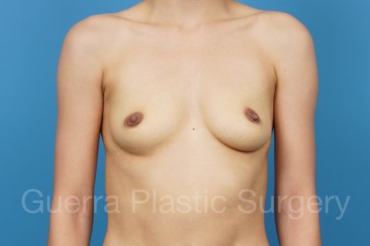 prev Case #39888 Before