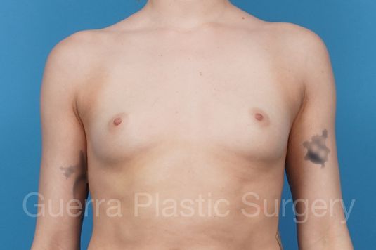 prev Case #41248 Before