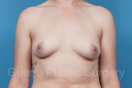 prev Case #41483 Before