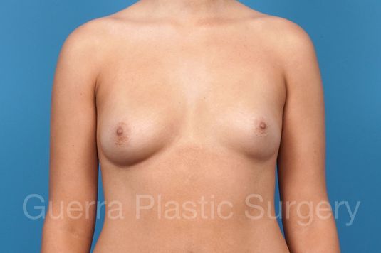 next Case #41275 Before