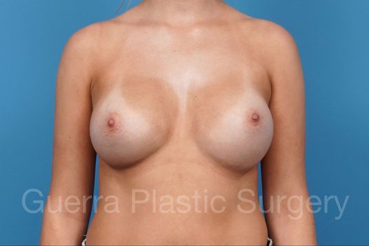 next Case #41275 After