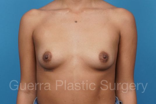 next Case #43927 Before