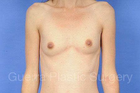 prev Case #31534 Before