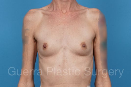 prev Case #43864 Before