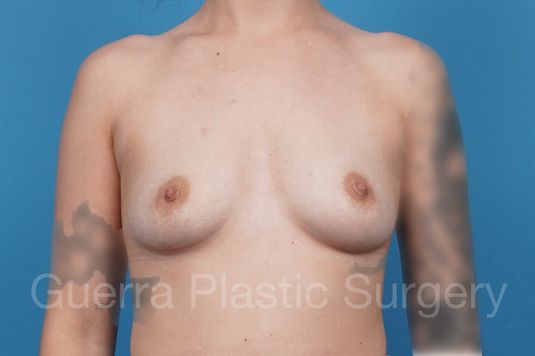 next Case #44120 Before