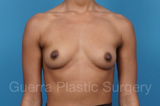 next Case #44079 Before