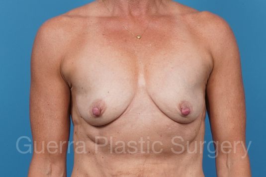 prev Case #42871 Before