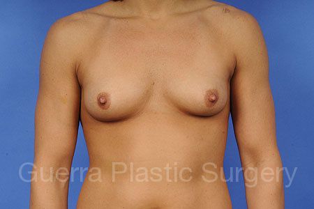 prev Case #86999 Before