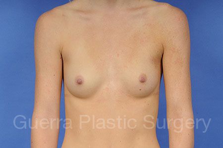 prev Case #85968 Before