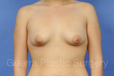 next Case #25879 Before