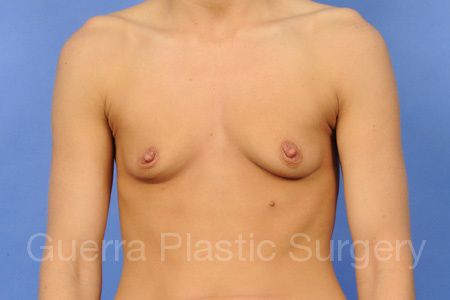 next Case #45983 Before