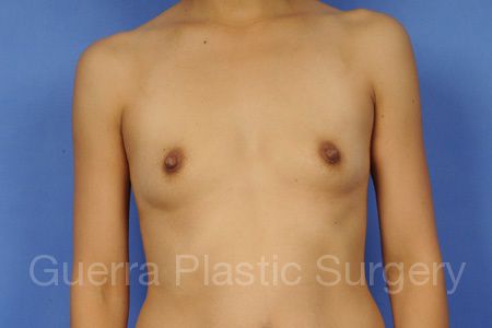 prev Case #35769 Before